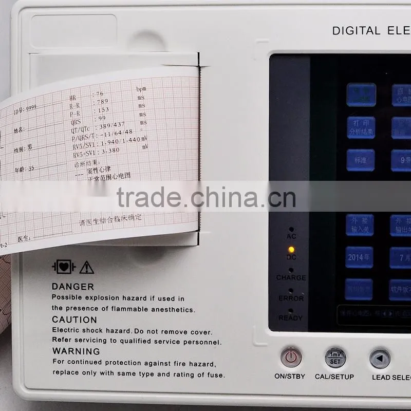 Hospital 7 inch color graphic LCD display portable 3 channels 12 lead ecg machine