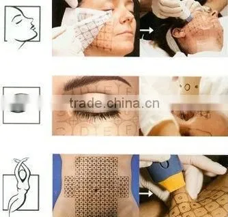 monopolar/ micro needle rf / fractional rf micro needle machine