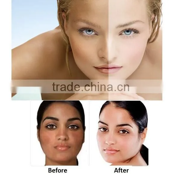 Chinese face rose pink skin whitening cream for freckles