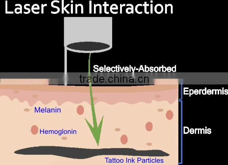 Skin beauty laser machine q-swich with C-Tips for black doll treatment