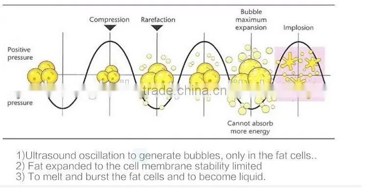 2016 new best effective ultrasharp Fat 3D positioning system