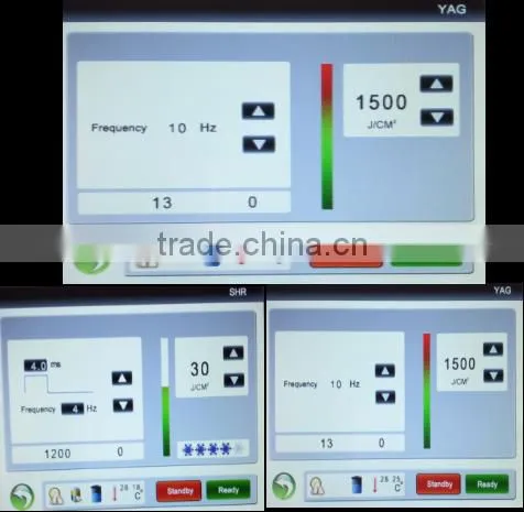 Super shr hair removal machine with nd yag laser system