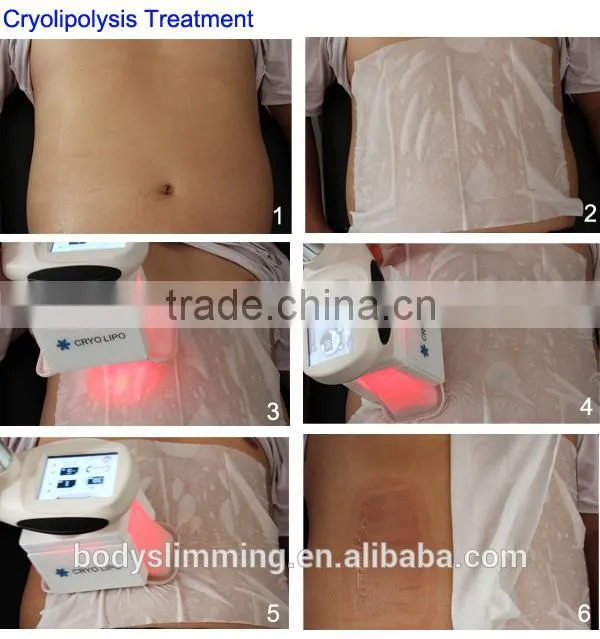 Slimming freeze weight loss fast fit weight loss
