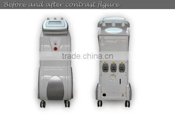 Christmas promotion! Factory price ipl handpiece plug