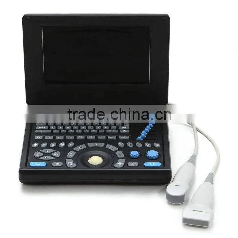 laptop ultrasound scanner with 3D function