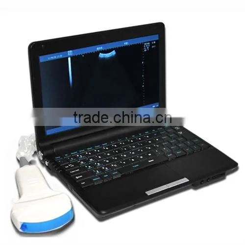 10 inch laptop Veterinary Ultrasound Scanner vet Convex Probe rectal probe optional