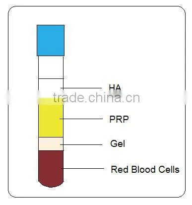 Sterile and pyrogenic free HA PRP tube, hyaluronic acid prp tube