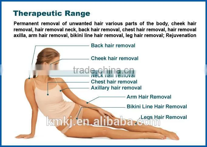 The most popular diode laser 808nm laser of hair removal