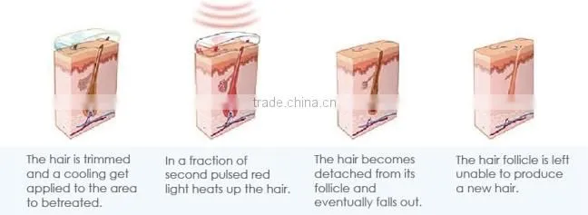 Hot sale! Most advanced beauty salon/spa use newest 808nm diode laser with CE