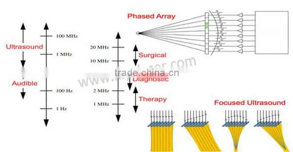 Most popular hifu treatment