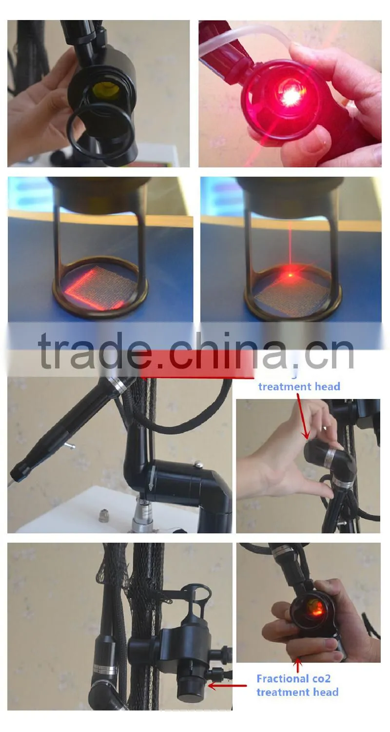 New technology fractional co2 laser scar removal, fractional co2 vagina rejuvenation laser