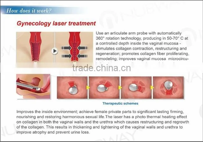 40W Fractional CO2 Laser Acne Scar & Wrinkle Removal / Co2 Laser Surgical Product Vaginal Applicator