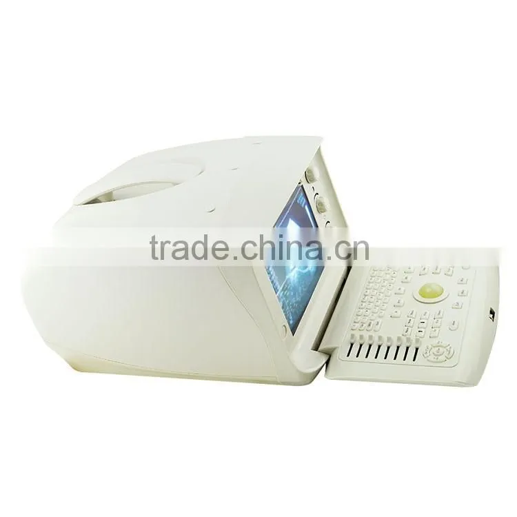 cheap prices of medical ultrasound machine for pregnancy