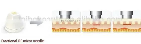 portable RF machine RF eye lifting machine RF Lifting Face Beauty Machine