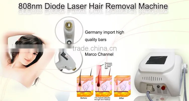 professional painless 808nm diode laser in hair removal