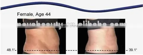 Alibaba China Suppier radio frequency?device photon light therapy machine cavitation slimming machine,New face NV-i3