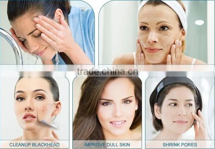 NL-SPA900 BEST! Portable diamond dermabrasion with diamond heads for skin rejuvenation machine (CE)