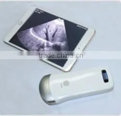 UltraSound Scanner, Convex Probe Ultrasound Scanner, WiFi, 3.5MHz / R40 / 64 Elements, SIFULTRAS-5.1