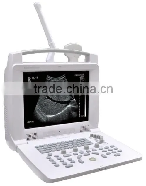 imported 12 " LCD Handled USB B Ultrasound machine in white color