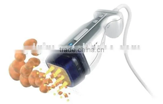 Good quality ultrasound hifu equipment manufacturer want distrobutor