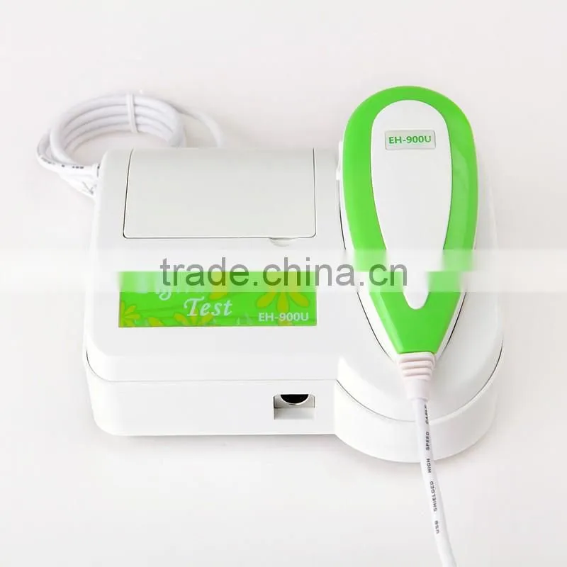 Hot sale new 5.0 MP high resolution CCD USB skin and hair scope analysis/analyzer