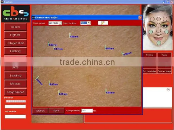 professional made in Taiwan skin magnifier portable skin analysis equipment