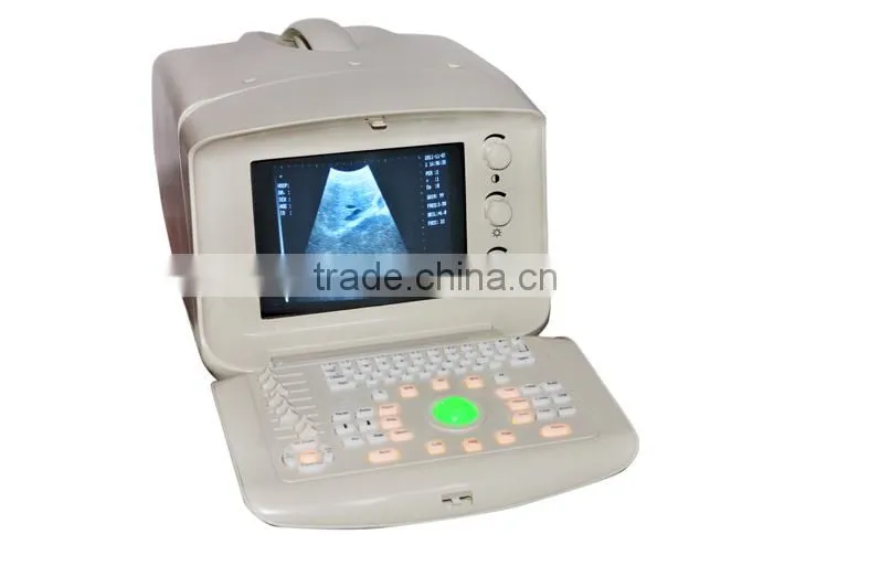 2016 CE Approved Digital Portable Style Ultrasound Machine/Scanner with cheap price