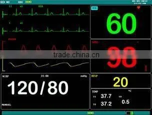 F5 Multi-parameter Monitor