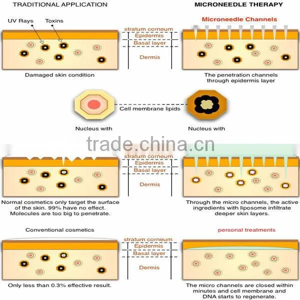 derma roller factory direct wholesale,derma skin roller,medical grade derma roller