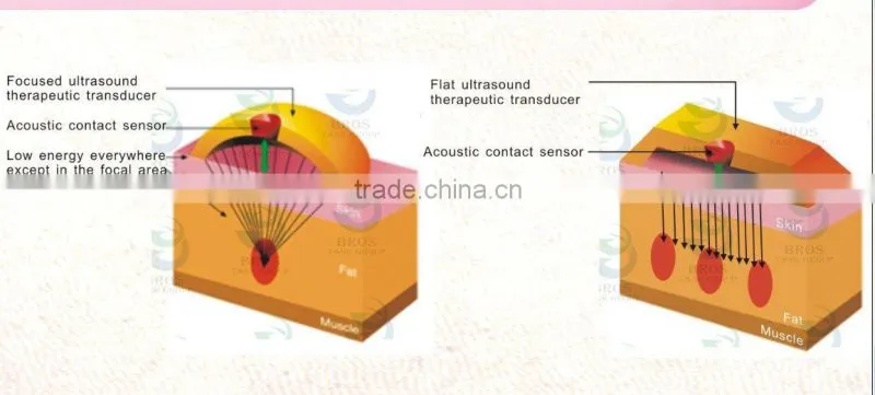 Vacuum Cavitation Ultrasonic Cavitation Slimming Machine