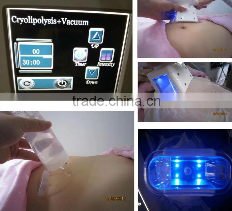 Hotsale 3 in 1 Cryo Slimming Machine with Ultrasonic RF
