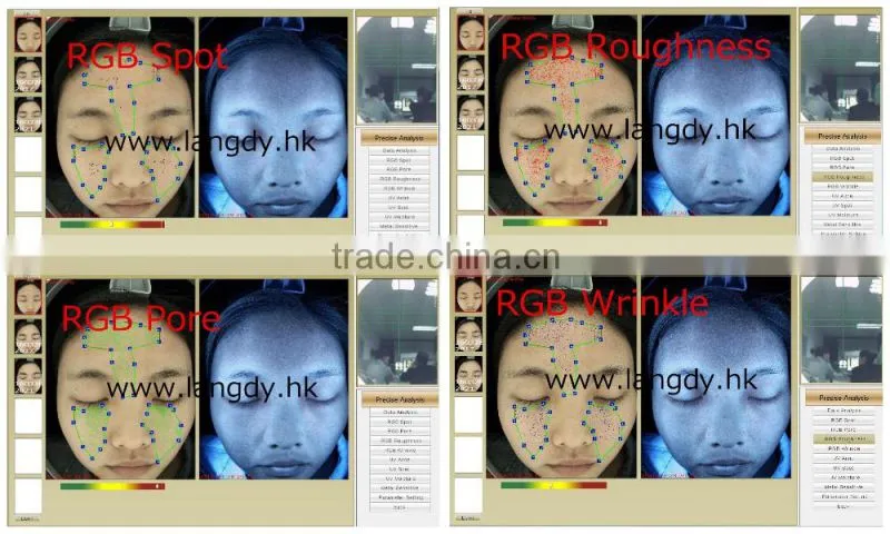 computer software skin analysis system acne wrinkle spot pore analyzer device