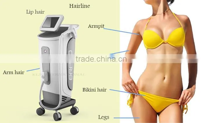 Diode 808nm laser system home laser hair removal machine