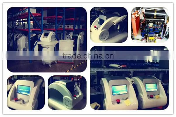 Tattoo machine nd yag laser removal
