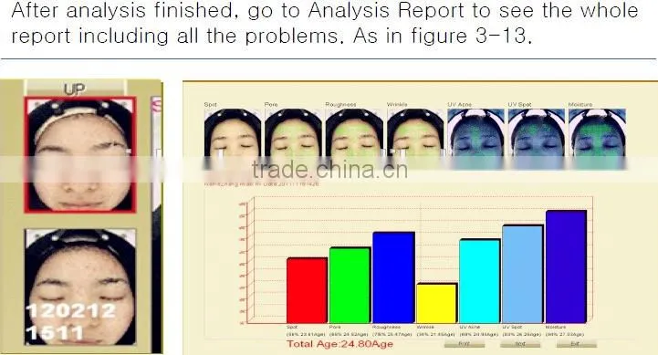skin analyzer software