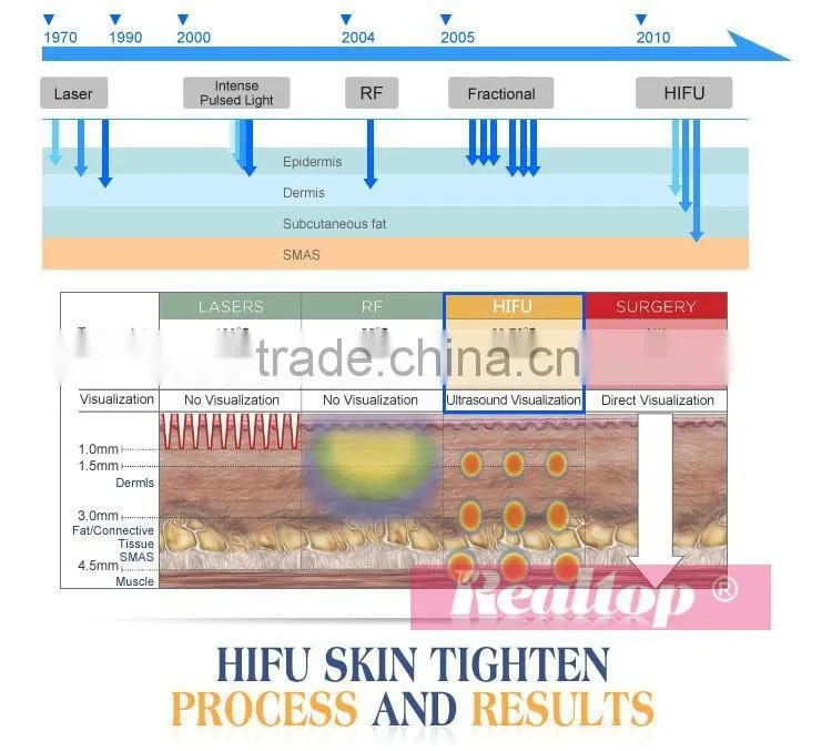 Best Selling Products High Intensity Focused Ultrasound Hifu Facial Lifting Anti Wrinkle With Hifu Cartridge