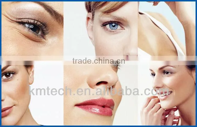 Effective nd yag laser tattoo removal machine