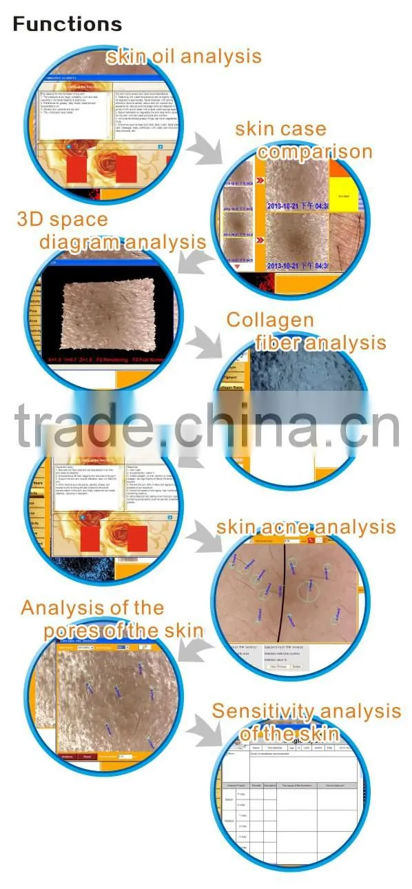 2014 High Quality Full Touch Screen Professional Intelligent Portable Skin Analyzer