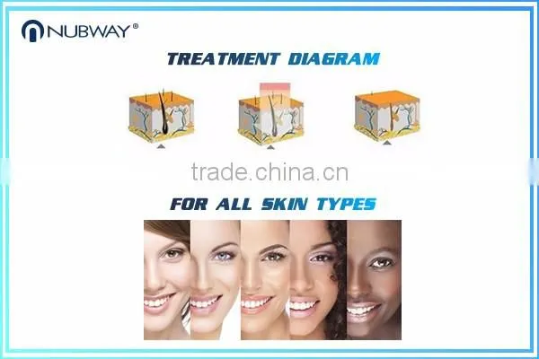808nm laser hair removal machine women hair removal device