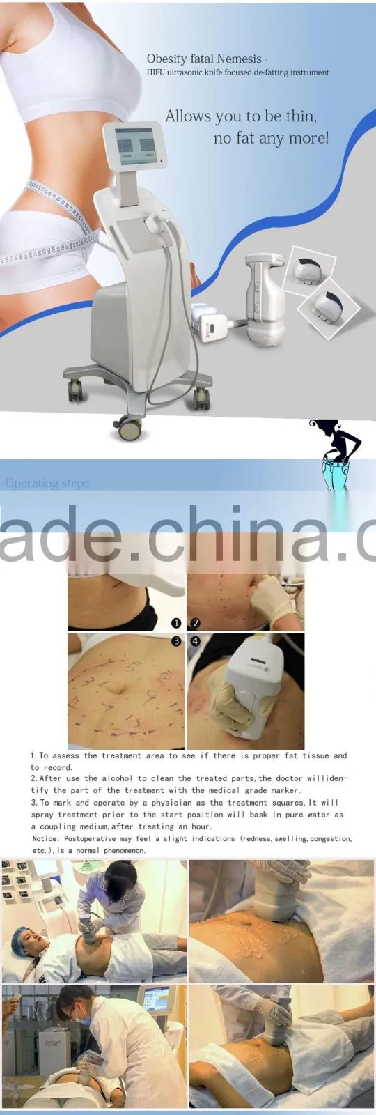 whole price ultrasound body slimming hifu ultra therapy