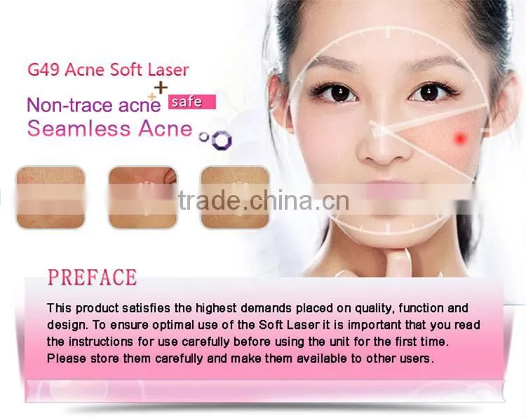 Best effective hot sale soft acne laser removal/acne treatments pen for sale