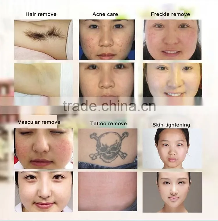 beauty salon equipment Face Lifting ipl eguipment for home