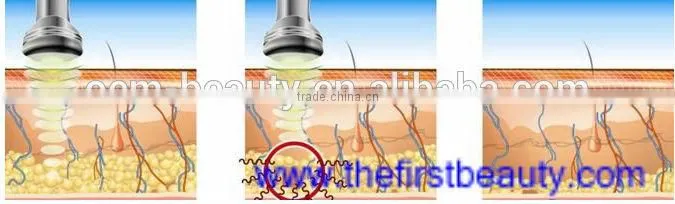 2016 Hot sale cooling fat reduction beauty machine
