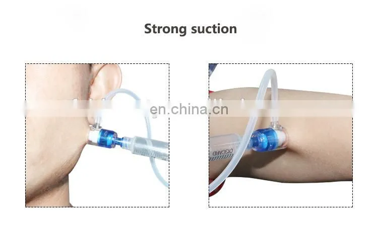 Smart Injection Mesotherapy Gun Water Spray Jet Peel Facial Machine Vital injector beauty device