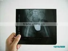 agfa digital film,medical x-ray image intensifier,t4 diagnostic