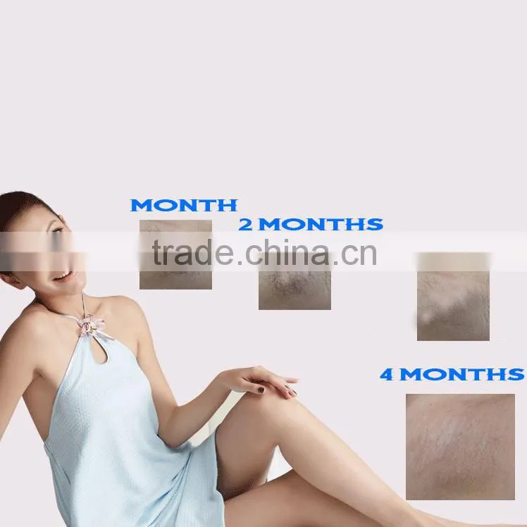 Best Choice Laser Cosmetic Equipment Portable Hair Removal Instrument in USA