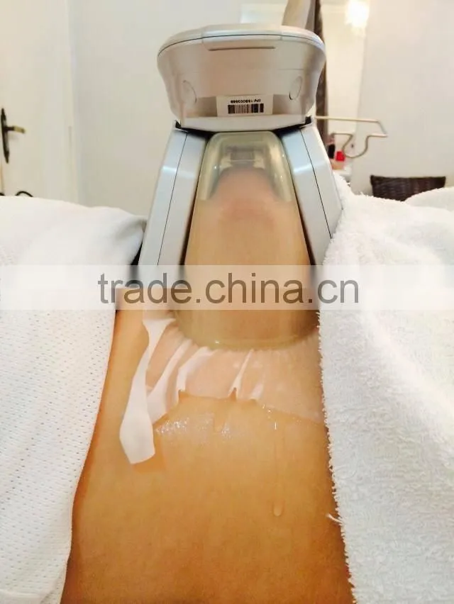 newest Cryolipolysis fat freeze Slimming lose weight machine for obesity