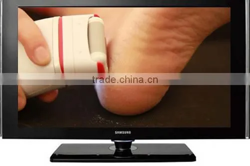 Professional Pedicure Callus Remover