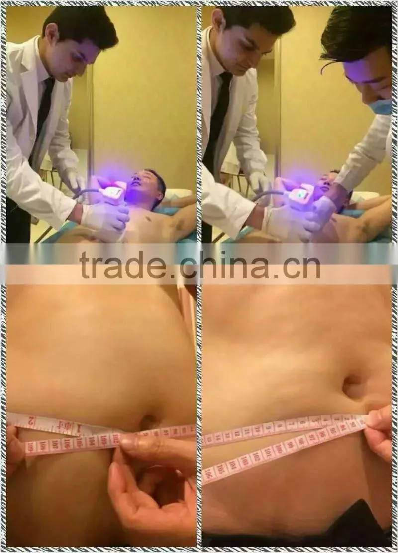LS08-laura trending hot beauty products body slimming hifu ultrashape liposonix machine