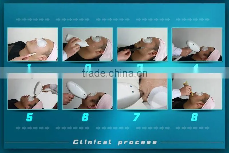 Professional permanent hair removal for men